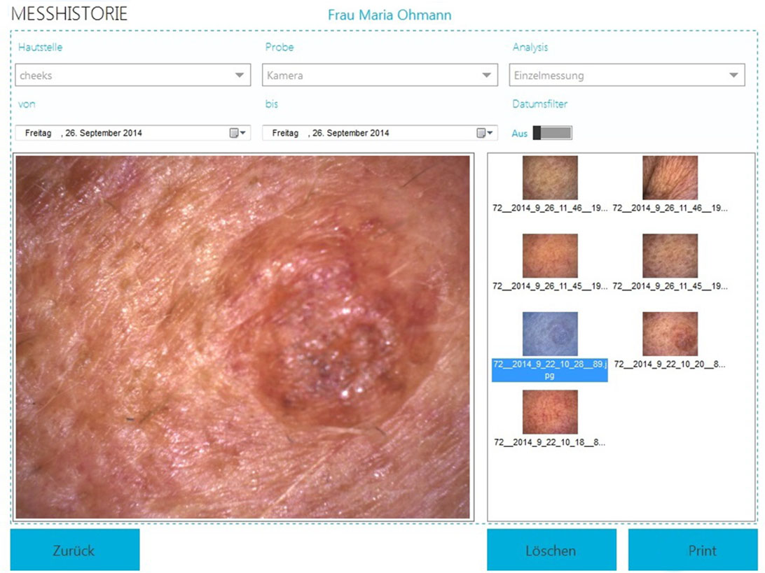 collect interesting images of different skin sites