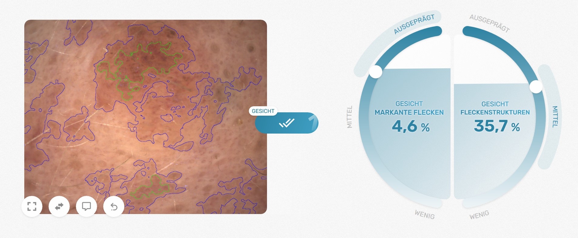 Visioscope®: detection of distinct spots and complex spot structures