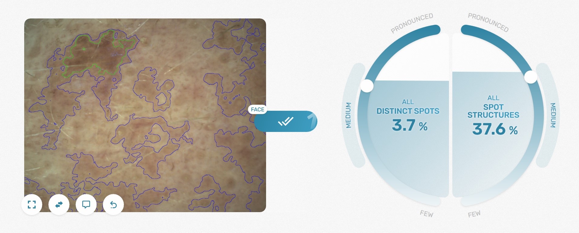 Visioscope®: detection of distinct spots and complex spot structures