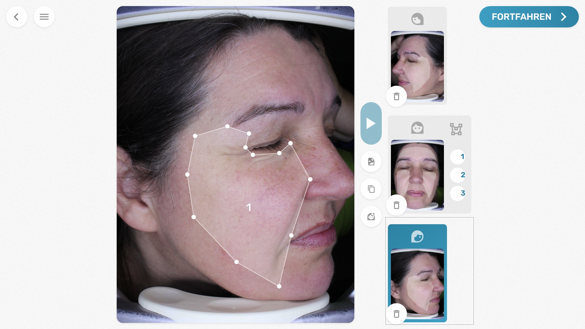 VisioFace® - durch Gesichtserkennung werden masken automatisch gesetzt