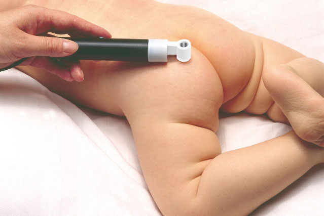 Tewameter® TM Hex - Messung auf Babyhaut