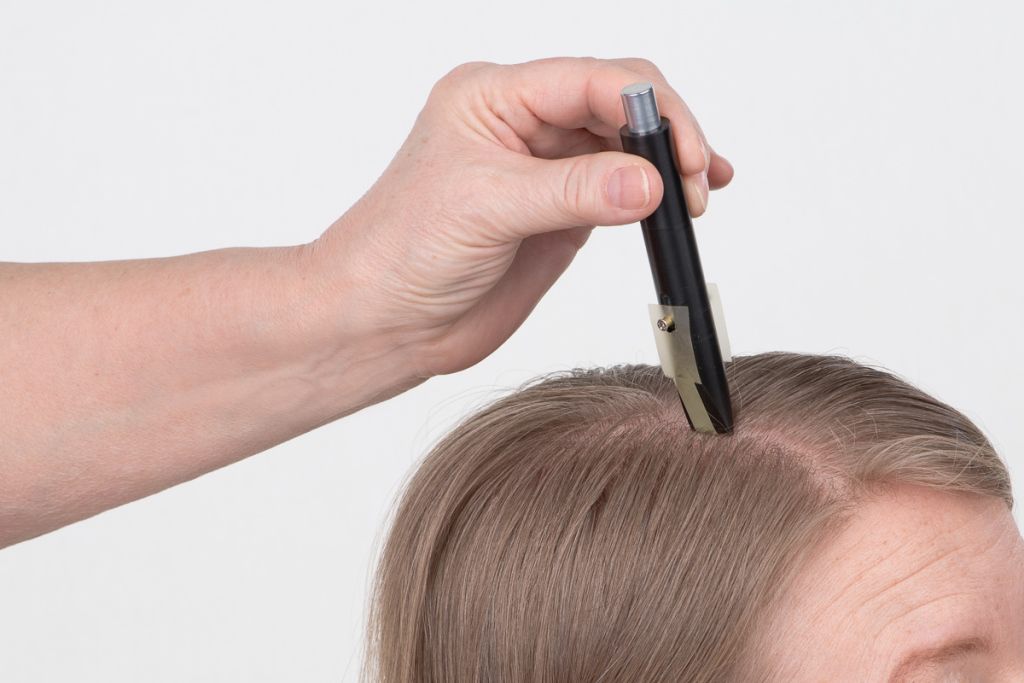 Meibometer® strips used on the scalp
